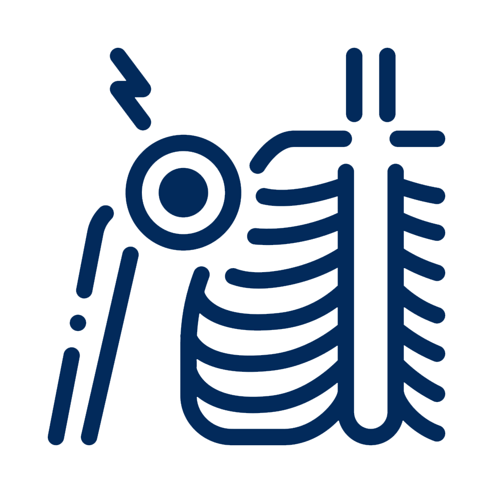 shoulder-arthritis iacon