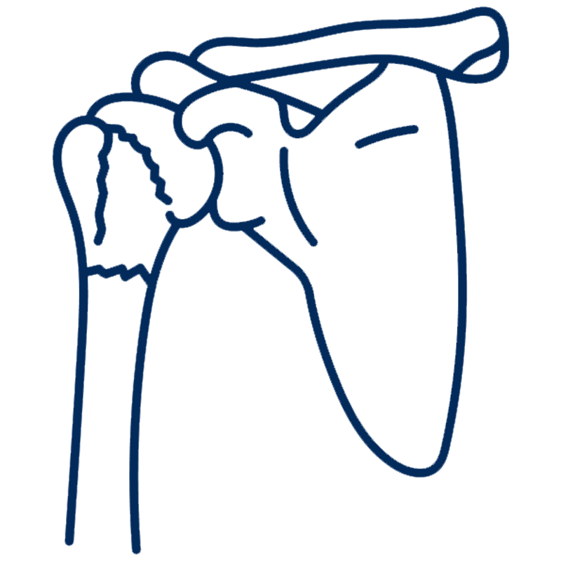 shoulder-fracture icon